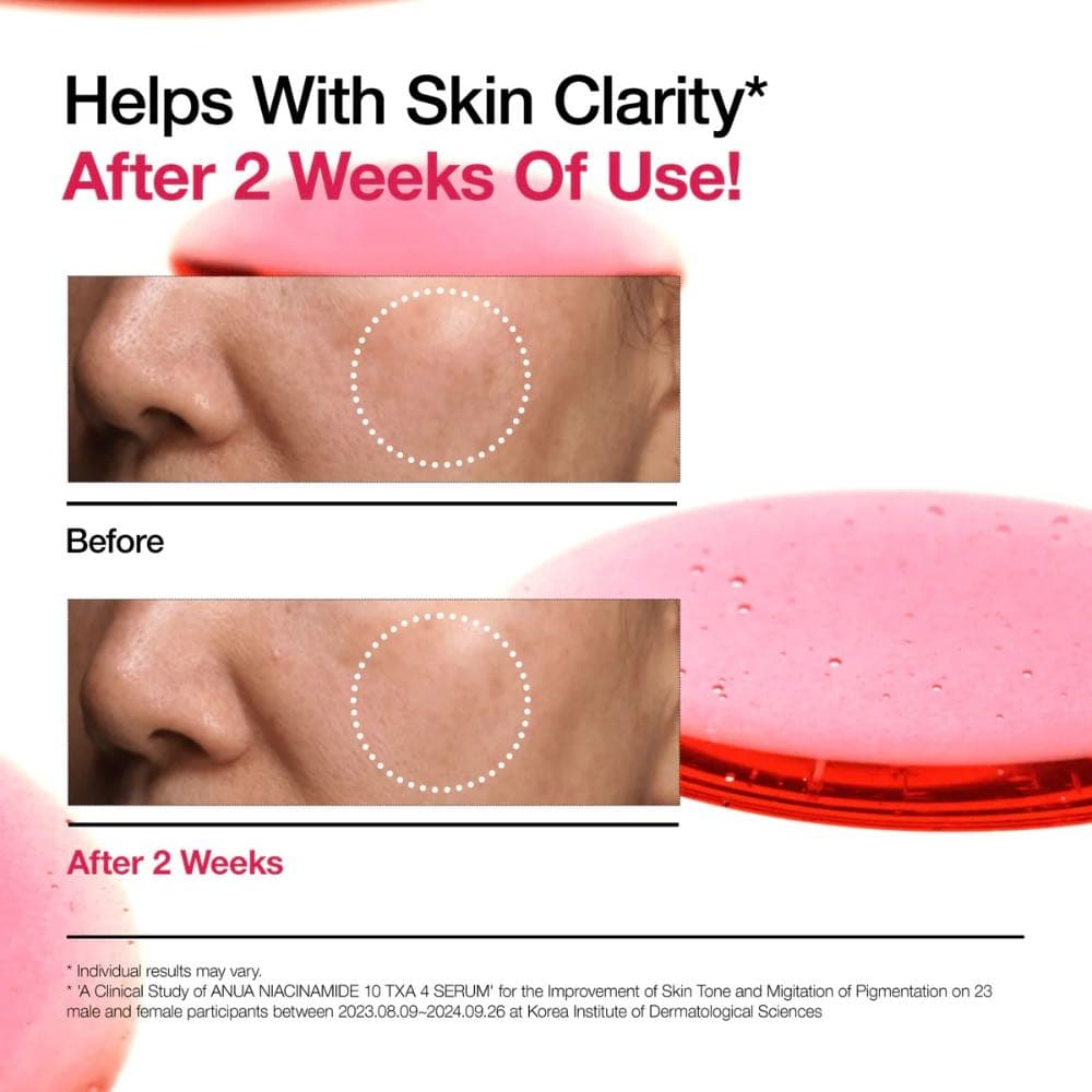 سيريوم نياسيناميد 10% لتفتيح التصبغات ANUA